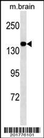 MED14 Monoclonal Antibody (483CT11.1.1)