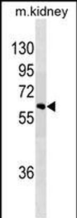SPRED1 Monoclonal Antibody (462CT2.5.1)