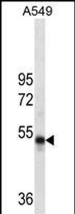 RUVBL1 Monoclonal Antibody (507CT2.2.2)