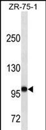 FUT4 Monoclonal Antibody (476CT26.8.4)