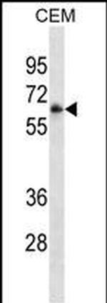 CD16 Antibody in Western Blot (WB)