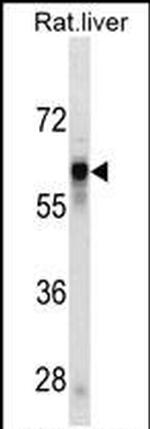 SERPINC1 Monoclonal Antibody (435CT4.7.4)