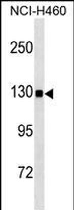 USP8 Monoclonal Antibody (460CT35.1.6)