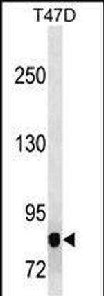 ZPK Monoclonal Antibody (473CT23.12.5)