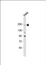 NOTCH3 Antibody in Western Blot (WB)