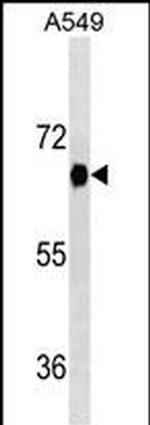 DYRK2 Monoclonal Antibody (492CT4.2.4)