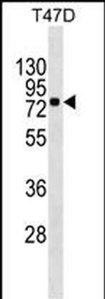 MX1 Monoclonal Antibody (474CT4.1.5)