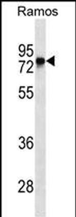 Btk Monoclonal Antibody (488CT2.1.2)