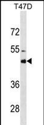 CYP3A4 Antibody in Western Blot (WB)