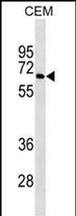 BLNK Monoclonal Antibody (520CT6.1.1)