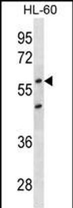 p57 Kip2 Monoclonal Antibody (522CT9.5.1)