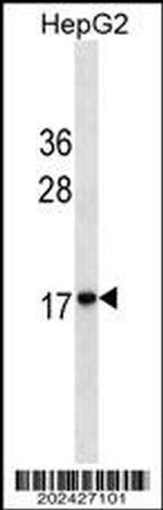 HMGA2 Antibody in Western Blot (WB)