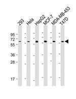 VDR Monoclonal Antibody (517CT23.5.1)