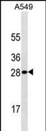 HPRT1 Antibody in Western Blot (WB)