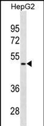 alpha-1 Microglobulin Monoclonal Antibody (472CT11.5.4)
