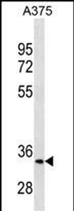 MC1R Monoclonal Antibody (578CT6.2.3)