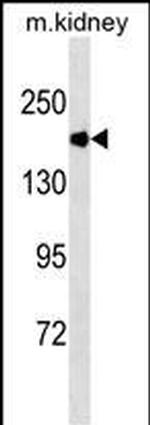 ACE Monoclonal Antibody (536CT24.1.3)