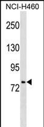 HNF1A Monoclonal Antibody (622CT11.9.6)