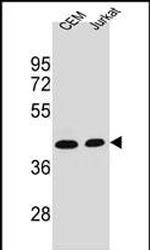 Adenosine Deaminase Monoclonal Antibody (608CT2.1.3)