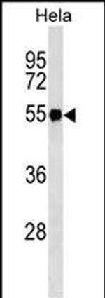 Fibrinogen gamma Monoclonal Antibody (546CT11.4.3)