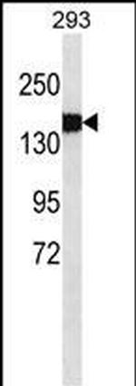 Collagen III Antibody in Western Blot (WB)