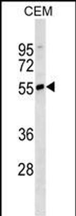 Human IgD Antibody in Western Blot (WB)