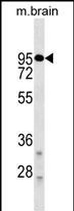 DRD2 Antibody in Western Blot (WB)