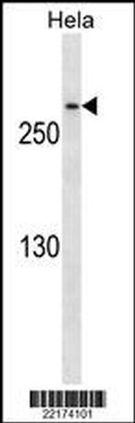 CDK5RAP2 Monoclonal Antibody (527CT22.9.2)