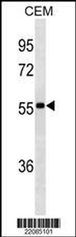 IGHA1 Monoclonal Antibody (585CT26.3.1)