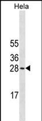 COMT Monoclonal Antibody (630CT1.7.1)