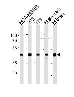 Creatine Kinase BB Monoclonal Antibody (893CT29.1.1)