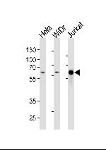 HDAC1 Antibody in Western Blot (WB)