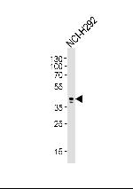 AIM2 Monoclonal Antibody (812CT9.2.2.1)