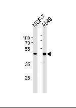 CDK20 Antibody in Western Blot (WB)