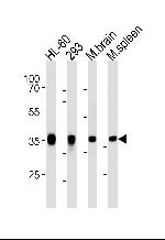 Aldolase C Monoclonal Antibody (859CT9.5.3)