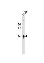 CDA Monoclonal Antibody (921CT14.2.1)