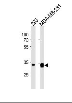 GOLPH3 Monoclonal Antibody (905CT9.1.1)