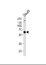 USP22 Monoclonal Antibody (1154CT13.1.3.1)