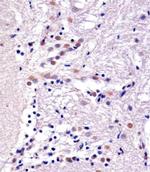 YY1 Monoclonal Antibody (1183CT6.5.23.6)