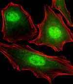 FUBP3 Monoclonal Antibody (1216CT820.155.150)