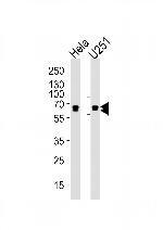 FUBP3 Antibody in Western Blot (WB)