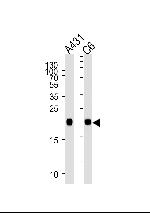 N-Ras Monoclonal Antibody (822CT17.5.1)
