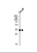 BOB-1 Monoclonal Antibody (1170CT1.1.1)