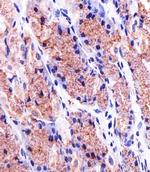 Prohibitin Monoclonal Antibody (1215CT487.109.106)