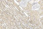 BBS4 Monoclonal Antibody (1292CT845.130.218)