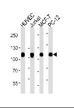 TOP1 Monoclonal Antibody (1291CT875.142.166)
