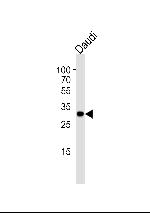 Bcl-10 Antibody in Western Blot (WB)