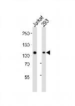 MAGED1 Monoclonal Antibody (1305CT862.157.127)