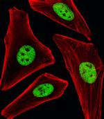 SP1 Monoclonal Antibody (1326CT463.109.176)