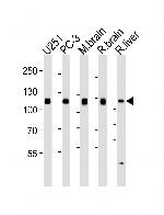 USP5 Monoclonal Antibody (1340CT704.170.140)